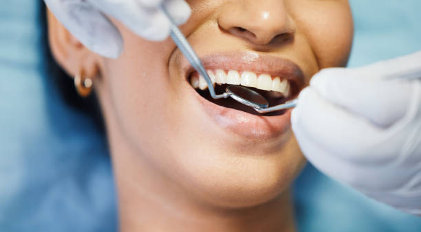 Best Pediatric Emergency Dentist in Wardsville, MO