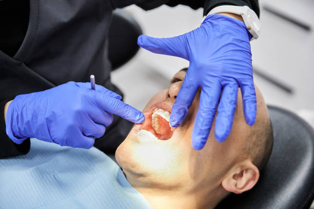 Best Urgent Care for Lost Fillings or Crowns in Wardsville, MO