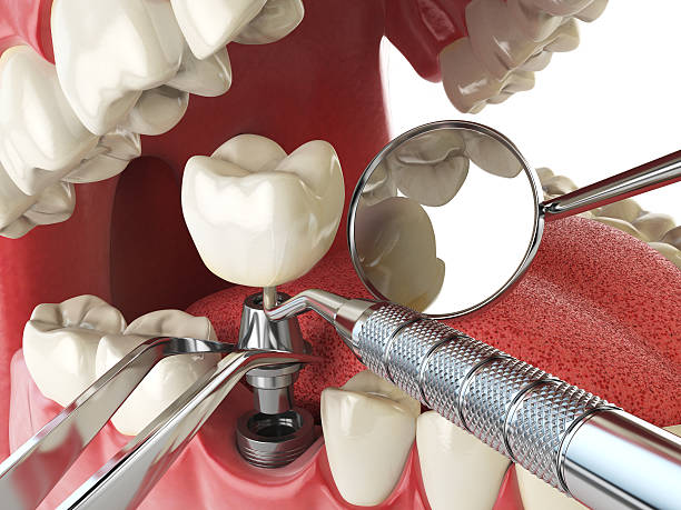 Best After-Hours Dental Trauma Care in Wardsville, MO